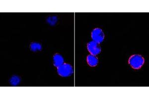 Confocal immunofluorescence analysis of BCBL-1 cells (left) and L1210 cells (right) using CD18 mouse mAb (red).