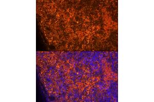 Immunofluorescence analysis of Rat spleen using CCL5/RANTES antibody (ABIN6129369, ABIN6138063, ABIN6138065 and ABIN6218473) at dilution of 1:100.