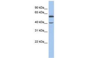 Image no. 1 for anti-Cytochrome P450, Family 4, Subfamily V, Polypeptide 2 (CYP4V2) (AA 431-480) antibody (ABIN6743946)