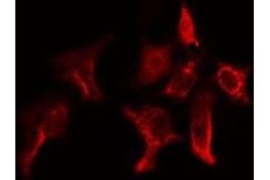 ABIN6275155 staining Hela cells by IF/ICC. (GSTT1 anticorps  (N-Term))