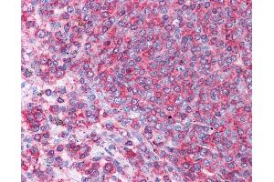 HSPA8 antibody was used for immunohistochemistry at a concentration of 4-8 ug/ml. (Hsc70 anticorps  (N-Term))