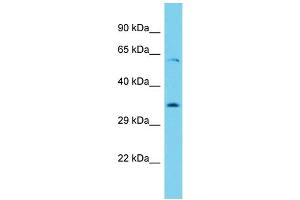 Host: Rabbit Target Name: Ythdf1 Sample Type: Rat Thymus lysates Antibody Dilution: 1. (YTHDF1 anticorps  (N-Term))
