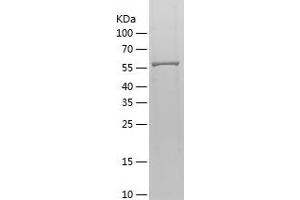 Western Blotting (WB) image for Mesothelin (MSLN) (AA 37-598) protein (His-IF2DI Tag) (ABIN7123919)