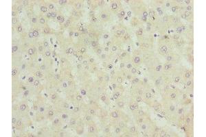 Immunohistochemistry of paraffin-embedded human liver tissue using ABIN7142596 at dilution of 1:100 (ALAS2 anticorps  (AA 50-587))