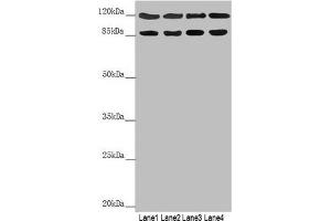Western blot All lanes: SCYL1 antibody at 3. (SCYL1 anticorps  (AA 460-740))