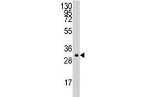 Western blot analysis of Cyclin C antibody and HL-60 lysate.
