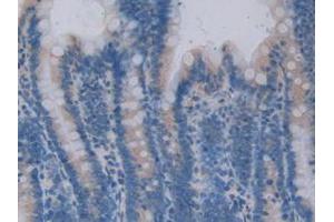 IHC-P analysis of Rat Intestine Tissue, with DAB staining. (ADAP2 anticorps  (AA 49-360))