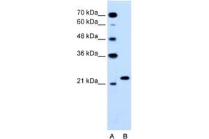 Western Blotting (WB) image for anti-RAB14, Member RAS Oncogene Family (RAB14) antibody (ABIN2463772) (RAB14 anticorps)