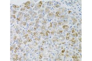 Immunohistochemistry of paraffin-embedded Mouse stomach using HPS1 Polyclonal Antibody at dilution of 1:100 (40x lens). (HPS1 anticorps)
