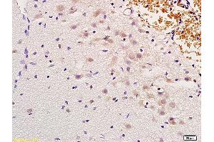 Formalin-fixed and paraffin embedded rat brain labeled with Anti-MSH gamma Polyclonal Antibody, Unconjugated (ABIN751123) at 1:200 followed by conjugation to the secondary antibody and DAB staining (gamma MSH (AA 51-150) anticorps)