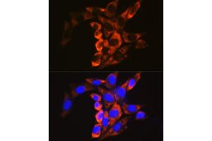 Immunofluorescence analysis of NIH/3T3 cells using Calpain 1 antibody (ABIN3021622, ABIN3021623, ABIN3021624, ABIN1512666 and ABIN6215416) at dilution of 1:100. (CAPNL1 anticorps  (AA 20-330))