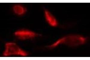 ABIN6278062 staining HepG2 by IF/ICC. (Ferredoxin1 (FDX1) (Internal Region) anticorps)