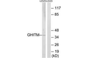 Western Blotting (WB) image for anti-Growth Hormone Inducible Transmembrane Protein (GHITM) (AA 31-80) antibody (ABIN2890353) (GHITM anticorps  (AA 31-80))