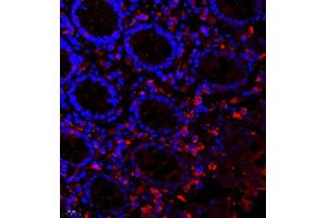 Immunofluorescence of paraffin embedded human colon using scr3 (ABIN7074886) at dilution of 1:2000 (400x lens)