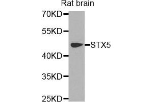 Western blot analysis of extracts of rat brain cells, using STX5 antibody.