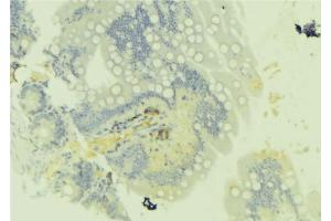 ABIN6279744 at 1/100 staining Mouse colon tissue by IHC-P.