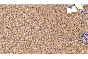Detection of LPL in Rat Liver Tissue using Polyclonal Antibody to Lipoprotein lipase (LPL) (Lipoprotein Lipase anticorps  (AA 28-474))