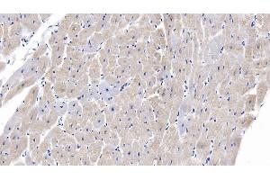 Detection of SEMA5B in Human Cardiac Muscle Tissue using Monoclonal Antibody to Semaphorin 5B (SEMA5B)