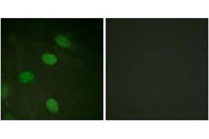 Immunofluorescence analysis of HeLa cells, using c-Jun (Phospho-Thr231) Antibody. (C-JUN anticorps  (pThr231))
