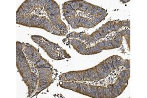 IHC analysis of UNG using anti UNG antibody (ABIN7602695).