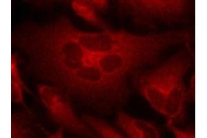 Immunofluorescence staining of methanol-fixed Hela cells using Bcr(Ab-177) Antibody. (BCR anticorps)