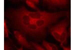 Immunofluorescence staining of methanol-fixed Hela cells using Bcr(Ab-177) Antibody.