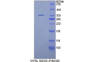 SDS-PAGE analysis of Rat Matrix Metalloproteinase 7 (MMP7) Protein. (MMP7 Protéine)