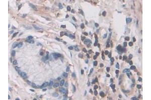 Detection of CFL1 in Human Stomach Tissue using Polyclonal Antibody to Cofilin 1 (CFL1)