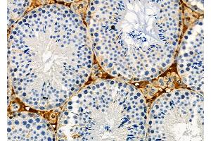 ABIN6262587 and ABIN6273127 at 1/100 staining Mouse testis tissue by IHC-P. (INHBA anticorps  (Internal Region))