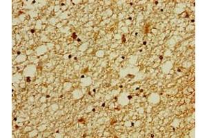 Immunohistochemistry of paraffin-embedded human brain tissue using ABIN7176339 at dilution of 1:100 (ZNF488 anticorps  (AA 1-200))