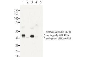 Image no. 1 for anti-Ribonucleotide Reductase M2 B (TP53 Inducible) (RRM2B) (N-Term) antibody (ABIN1104077) (RRM2B anticorps  (N-Term))