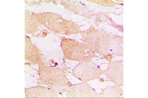 Immunohistochemical analysis of CD183 staining in human muscle formalin fixed paraffin embedded tissue section. (CXCR3 anticorps  (Center))