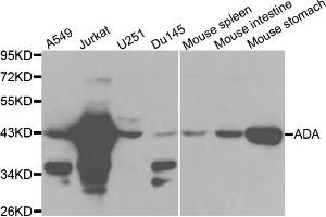 Western blot analysis of extracts of various cell lines, using ADA antibody. (ADA anticorps)