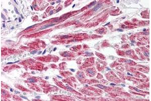 Human Heart (formalin-fixed, paraffin-embedded) stained with SNAI2 antibody ABIN214479 at 2. (SLUG anticorps  (Internal Region))