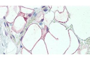 Immunohistochemistry of paraffin-embedded Adipose Tissue using DCBLD2 Polyclonal Antibody at dilution of 1:50. (DCBLD2 anticorps)