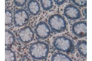 Detection of GLa in Human Rectum Tissue using Polyclonal Antibody to Galactosidase Alpha (GLa)