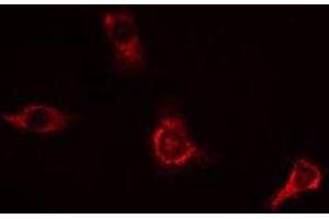 ABIN6269089 staining HeLa cells by IF/ICC. (APP anticorps  (C-Term))