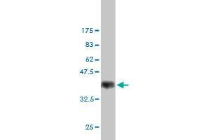 Western Blot detection against Immunogen (35.