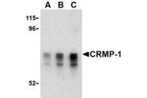 Western blot analysis of CRMP1 in Caco-2 cell lysate with AP30243PU-N CRMP1 antibody at (A) 1, (B) 2 and (C) 4 μg/ml. (CRMP1 anticorps  (Intermediate Domain))