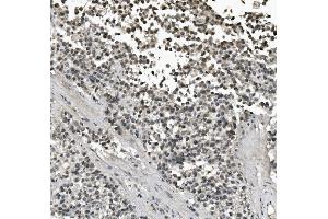IHC analysis of LIN28A using anti-LIN28A antibody (ABIN7601176).