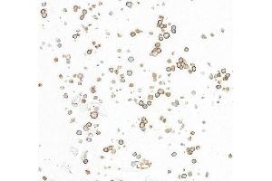 Immunocytochemistry (ICC) image for anti-CD86 (CD86) (AA 24-245) antibody (ABIN7795646) (Recombinant CD86 anticorps  (AA 24-245))