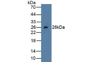 Detection of Recombinant OPG, Human using Polyclonal Antibody to Osteoprotegerin (OPG)