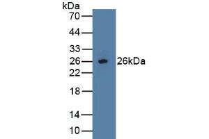 Detection of Recombinant OPG, Human using Polyclonal Antibody to Osteoprotegerin (OPG) (Osteoprotegerin anticorps  (AA 1-196))