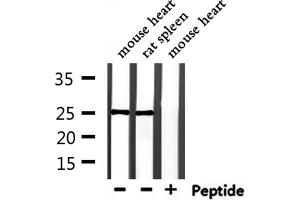 Western blot analysis of extracts from mouse heart and rat spleen, using RAB28 Antibody.