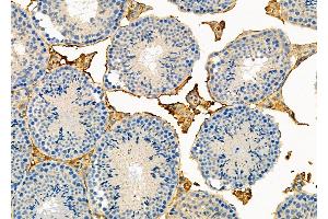 ABIN6264044 and ABIN6273287 at 1/100 staining Mouse testis tissue by IHC-P. (Parvin, beta anticorps  (C-Term))