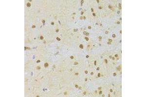 Immunohistochemistry of paraffin-embedded rat brain using HDGF Antibody. (HDGF anticorps  (AA 1-240))