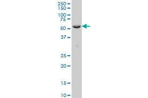FOXC2 monoclonal antibody (M03), clone 4B3 Western Blot analysis of FOXC2 expression in SJCRH30 .