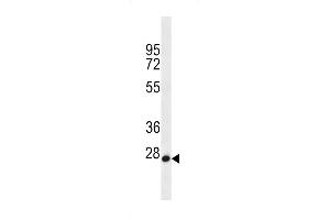 MED22 Antibody (N-term) (ABIN656595 and ABIN2845856) western blot analysis in HL-60 cell line lysates (35 μg/lane). (MED22 anticorps  (N-Term))