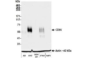 Western Blotting (WB) image for anti-CD86 (CD86) (AA 24-245) antibody (ABIN7795646) (Recombinant CD86 anticorps  (AA 24-245))