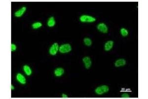 Immunostaining analysis in HeLa cells.